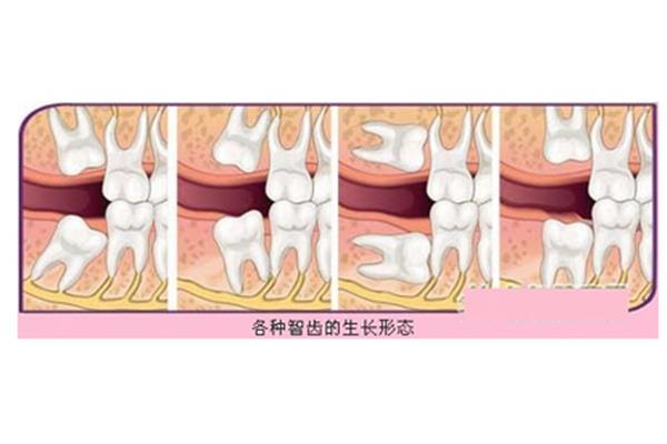 防校园欺凌感悟